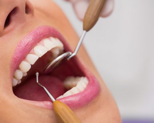 dentist-examining-female-patient-teeth